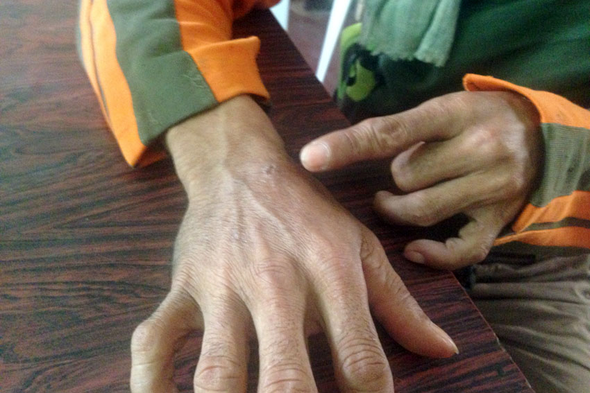 You are currently viewing Farmer tortured for ‘bringing rice for rebels’