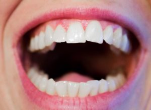 Read more about the article DOH to mark February as oral health care month
