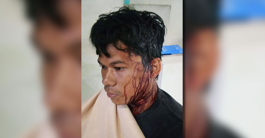 You are currently viewing Pepmaco guards attack sleeping workers, 12 injured